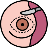 Illustration of a circular incision with a scalpel on a pink background