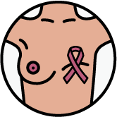Illustration of a breast with a pink ribbon, symbolizing breast cancer awareness.