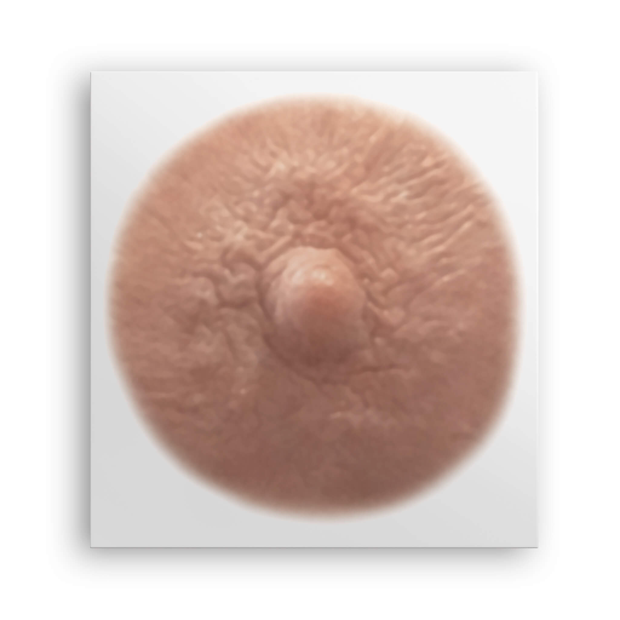 Cream shade post mastectomy temporary nipple tattoo due to breast cancer
